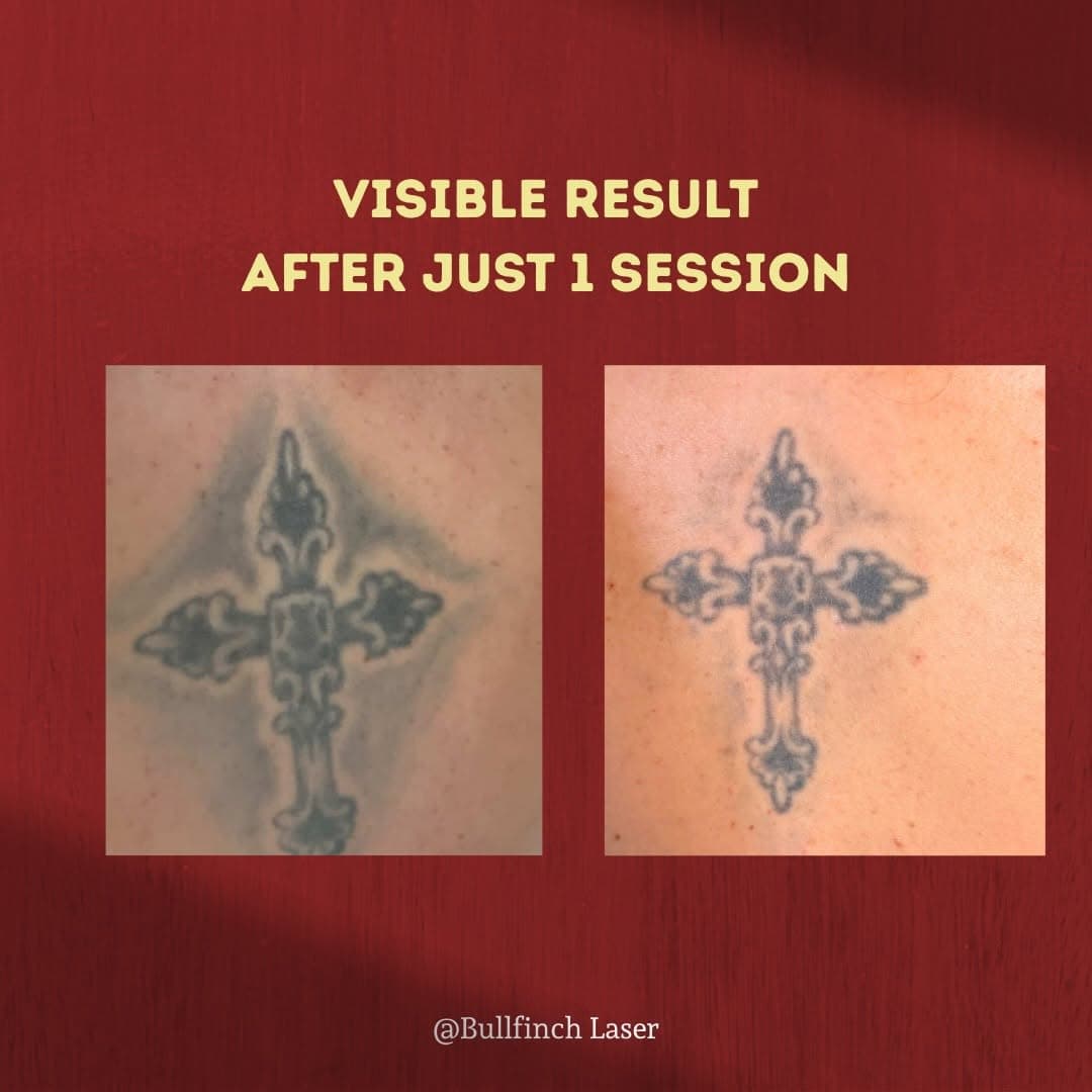 Tattoo work by Bullfinch Tattoo Atelier — photo 2 of 2