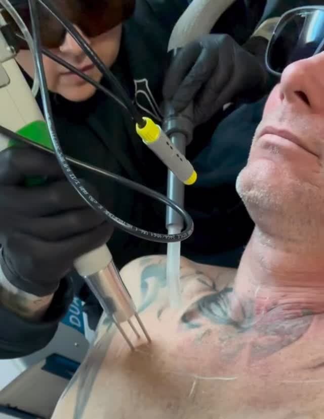 Tattoo work by Venom Laser — photo 2 of 4