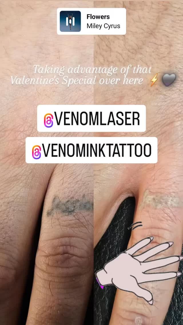 Tattoo work by Venom Laser — photo 3 of 4